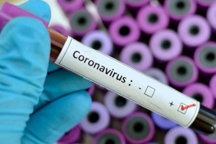 Per parą Lietuvoje – 90 naujų koronaviruso atvejų