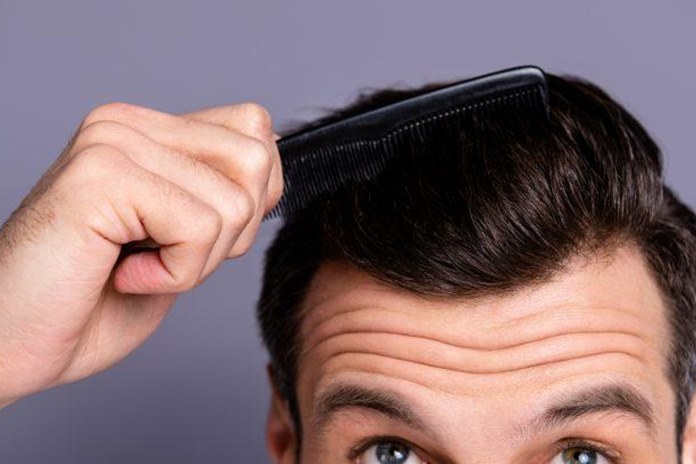 Pažangiausia plaukų persodinimo technologija leidžia susigrąžinti pasitikėjimą savimi